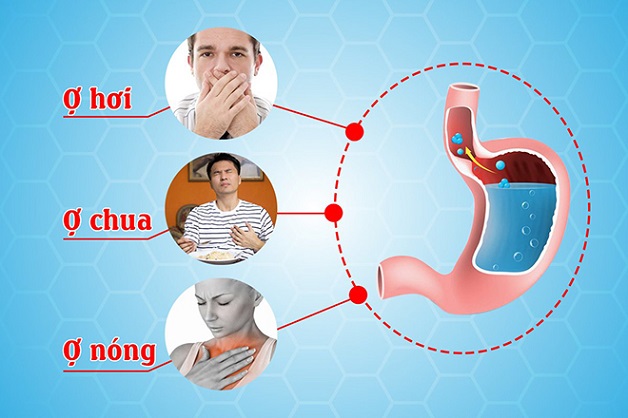 tác hại của axit dạ dày